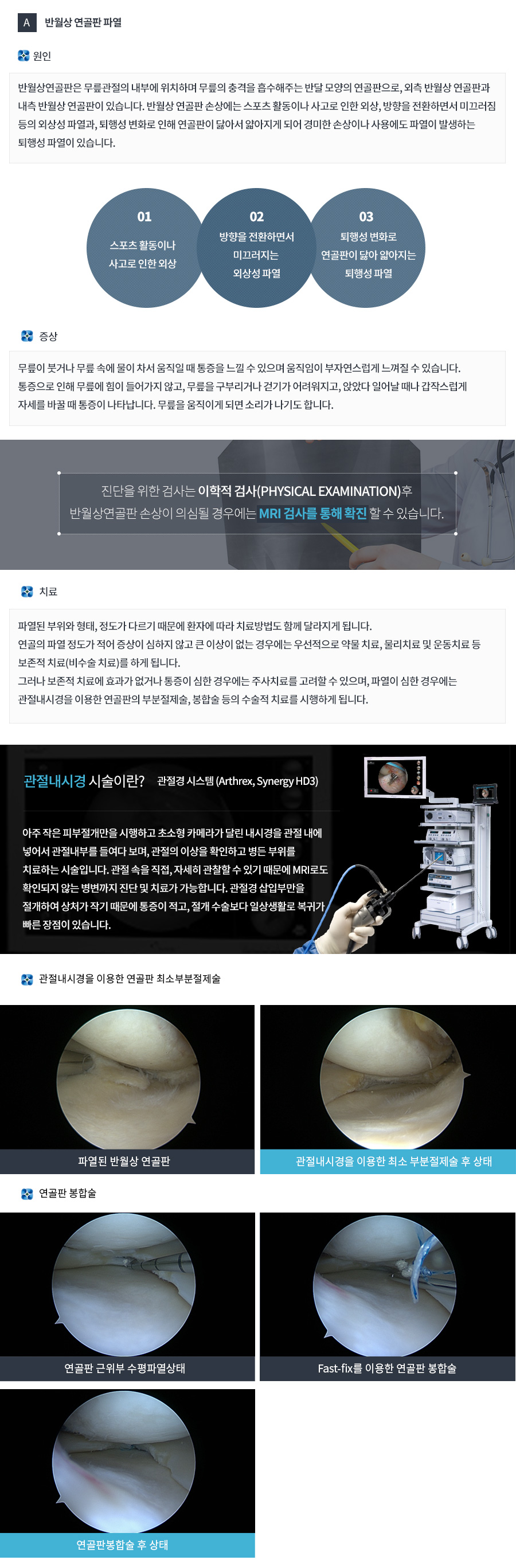A.	반월상 연골판 파열
원인
반월상연골판은 무릎관절의 내부에 위치하며 무릎의 충격을 흡수해주는 반달 모양의 연골판으로, 외측 반월상 연골판과 내측 반월상 연골판이 있습니다. 
반월상 연골판 손상에는 스포츠 활동이나 사고로 인한 외상, 방향을 전환하면서 미끄러짐 등의 외상성 파열과, 퇴행성 변화로 인해 연골판이 닳아서 얇아지게 되어 경미한 손상이나 사용에도 파열이 발생하는 퇴행성 파열이 있습니다.

증상
무릎이 붓거나 무릎 속에 물이 차서 움직일 때 통증을 느낄 수 있으며 움직임이 부자연스럽게 느껴질 수 있습니다. 통증으로 인해 무릎에 힘이 들어가지 않고, 무릎을 구부리거나 걷기가 어려워지고, 앉았다 일어날 때나 갑작스럽게 자세를 바꿀 때 통증이 나타납니다. 무릎을 움직이게 되면 소리가 나기도 합니다.

진단을 위한 검사는 이학적 검사(physical examination)후 반월상연골판 손상이 의심될 경우에는 MRI 검사를 통해 확진 할 수 있습니다.

치료
파열된 부위와 형태, 정도가 다르기 때문에 환자에 따라 치료방법도 함께 달라지게 됩니다. 
연골의 파열 정도가 적어 증상이 심하지 않고 큰 이상이 없는 경우에는 우선적으로 약물 치료, 물리치료 및 운동치료 등 보존적 치료(비수술 치료)를 하게 됩니다. 
그러나 보존적 치료에 효과가 없거나 통증이 심한 경우에는 주사치료를 고려할 수 있으며, 파열이 심한 경우에는 관절내시경을 이용한 연골판의 부분절제술, 봉합술 등의 수술적 치료를 시행하게 됩니다.

관절내시경 시술이란?
아주 작은 피부절개만을 시행하고 초소형 카메라가 달린 내시경을 관절 내에 넣어서 관절내부를 들여다 보며, 관절의 이상을 확인하고 병든 부위를 치료하는 시술입니다. 관절 속을 직접, 자세히 관찰할 수 있기 때문에 MRI로도 확인되지 않는 병변까지 진단 및 치료가 가능합니다. 관절경 삽입부만을 절개하여 상처가 작기 때문에 통증이 적고, 절개 수술보다 일상생활로 복귀가 빠른 장점이 있습니다. 
